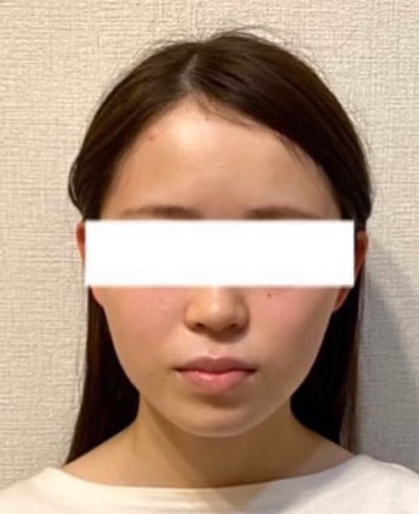 施術10回目