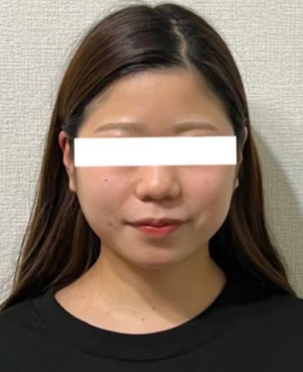 施術前