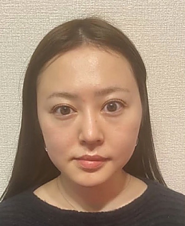 施術前