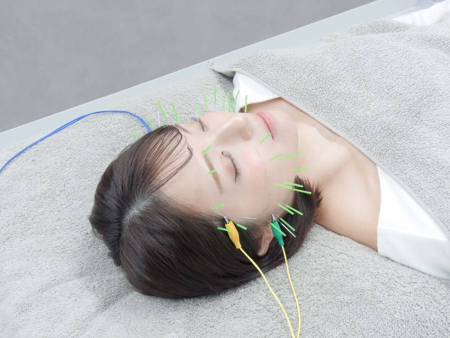 電気美容鍼